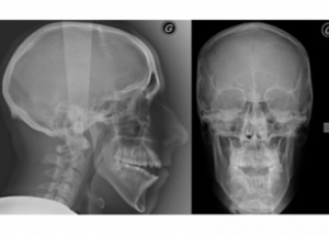 Image DES RADIOGRAPHIES FACE À ALZHEIMER